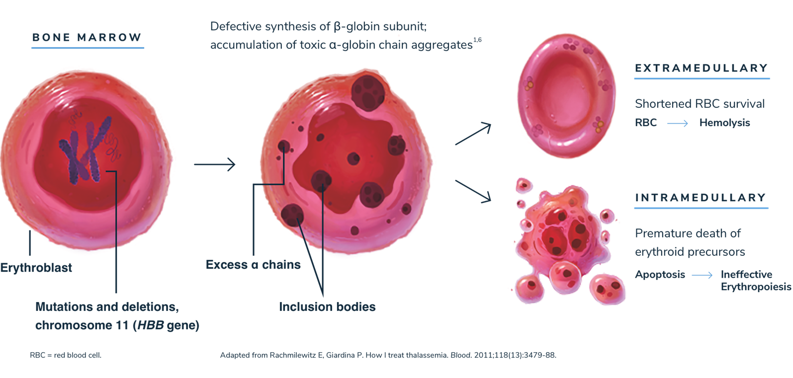 Beta Thalassemia Prevalence Pathophysiology And Inheritance